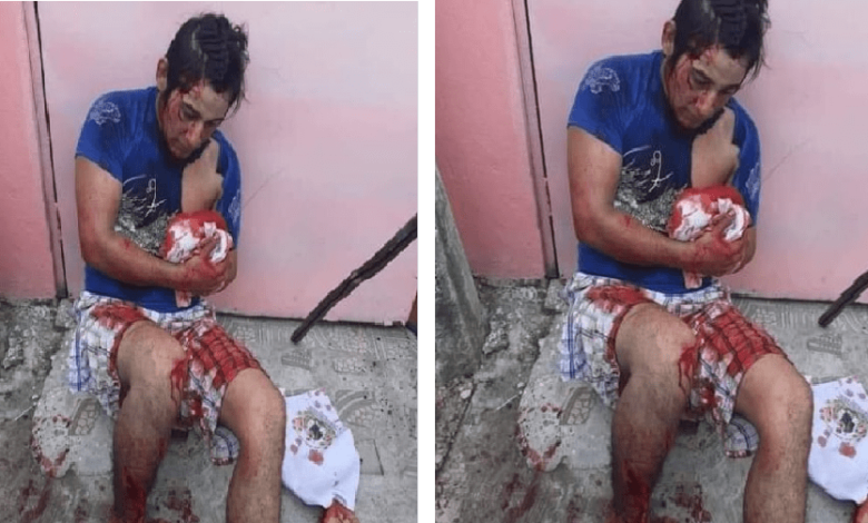 Linchan a delincuente, le cortaron la mano con un machete, ¡Salvaje escarmiento¡