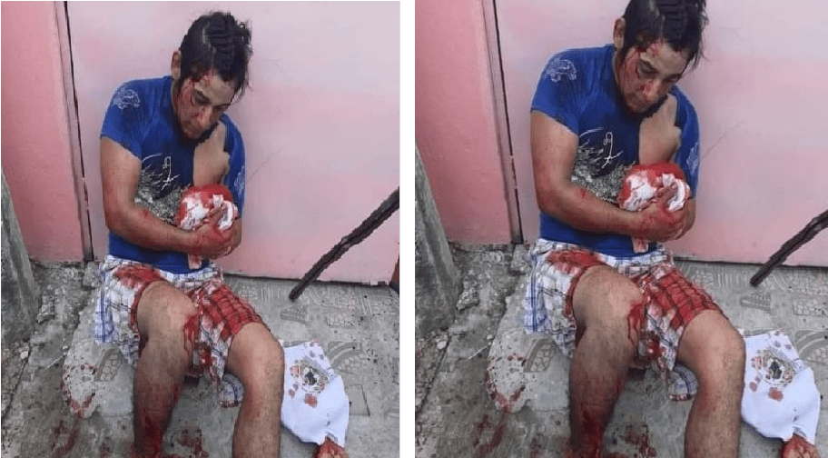 Linchan a delincuente, le cortaron la mano con un machete, ¡Salvaje escarmiento¡