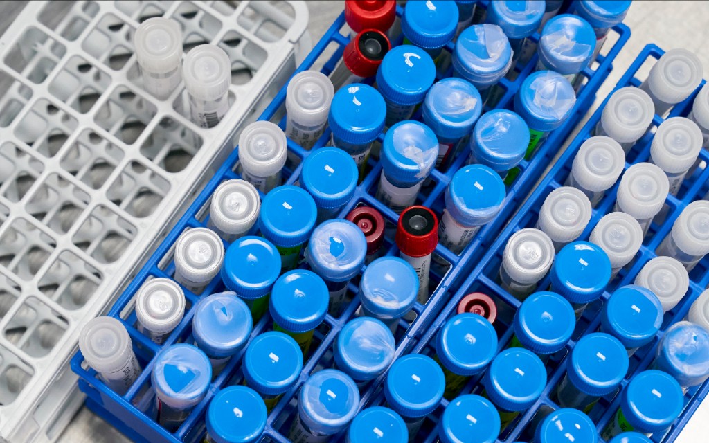 Vacuna china contra Covid-19, en fase 2, es segura e induce respuesta inmune