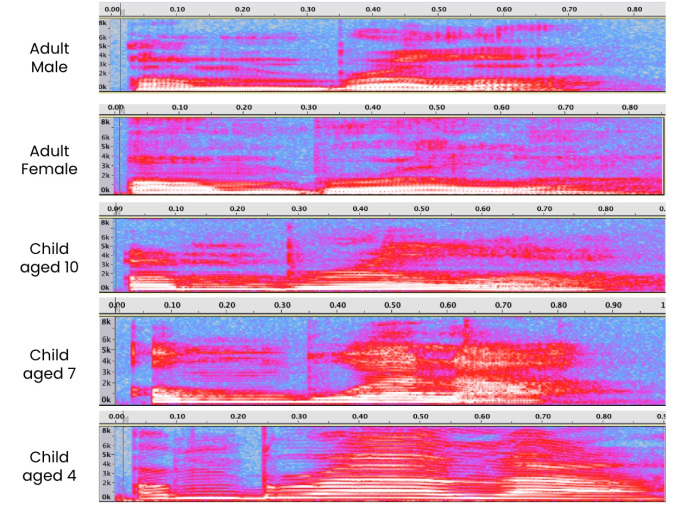 cambios de tono vocal con la edad