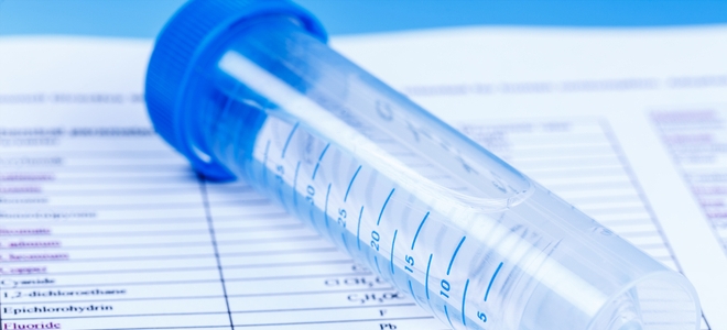 Cómo probar el agua del grifo