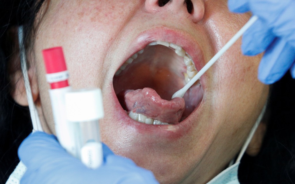 Anuncia OPS pruebas rápidas de Covid-19