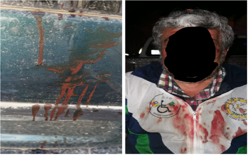 Golpean salvajemente a ciudadano, funcionarios del gobierno de Toño Mejía en Tequis, son de la familia Ferrusca
