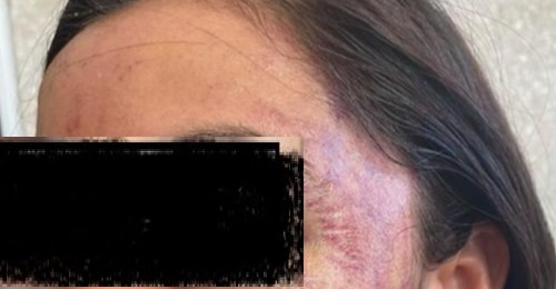 Identificado deportista que golpeó a una mujer, es Andrés Vargas; Premio Estatal del deporte, en Querétaro