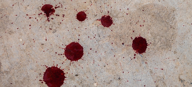 Cómo quitar las manchas de sangre de las superficies de cemento – La Neta  Neta