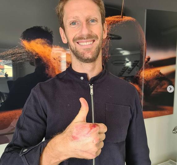 Grosjean muestra su mano tras quitarse el bendaje
