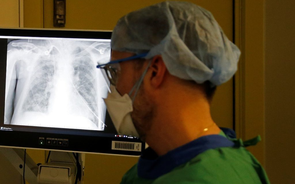 OMS dice que no hay necesidad de alarmar por nueva variante de coronavirus