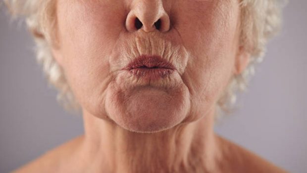 Arrugas en los labios: como combatir y eliminar el efecto «código de barras»