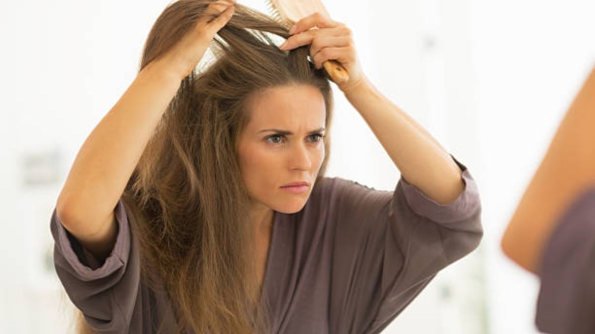 Los mejores remedios naturales para tratar la caspa