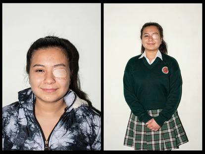 22/05/21 Jóvenes heridos en las protestas de Colombia. En la foto,  Sara Valentina Cárdenas, estudiante de 18 años. FOTO: CAMILO ROZO