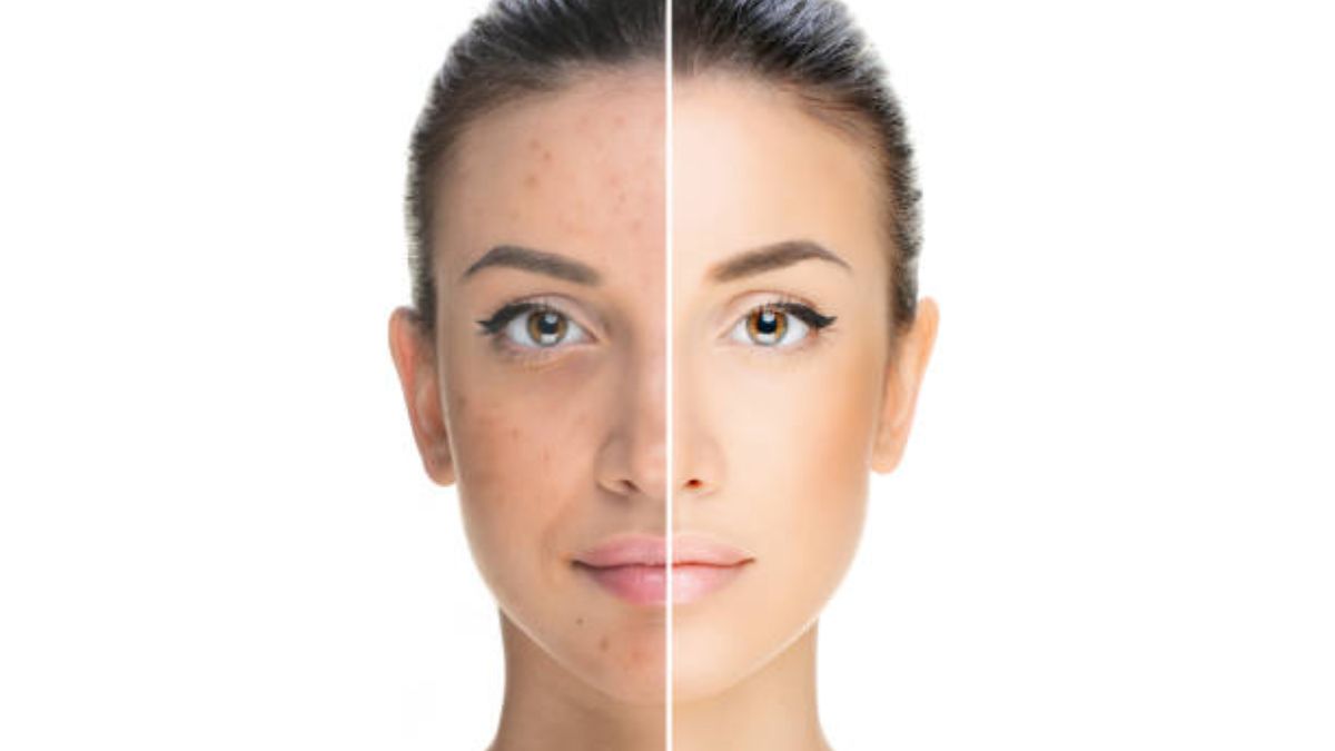 ¿Por qué tu cara es más oscura que tu cuerpo?