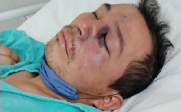 Detectan primer caso de “Hongo Negro” en un pueblo de México, El viacrucis de Gregorio para ser atendido