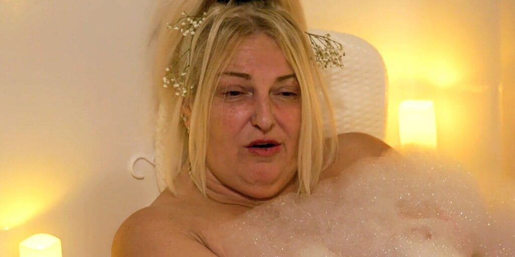 Prometido de 90 días: Angela tiene una cara diferente después de la cirugía para bajar de peso