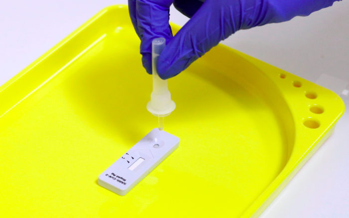 Organizadores de Juegos Olímpicos afrontan escasez de kits para pruebas Covid