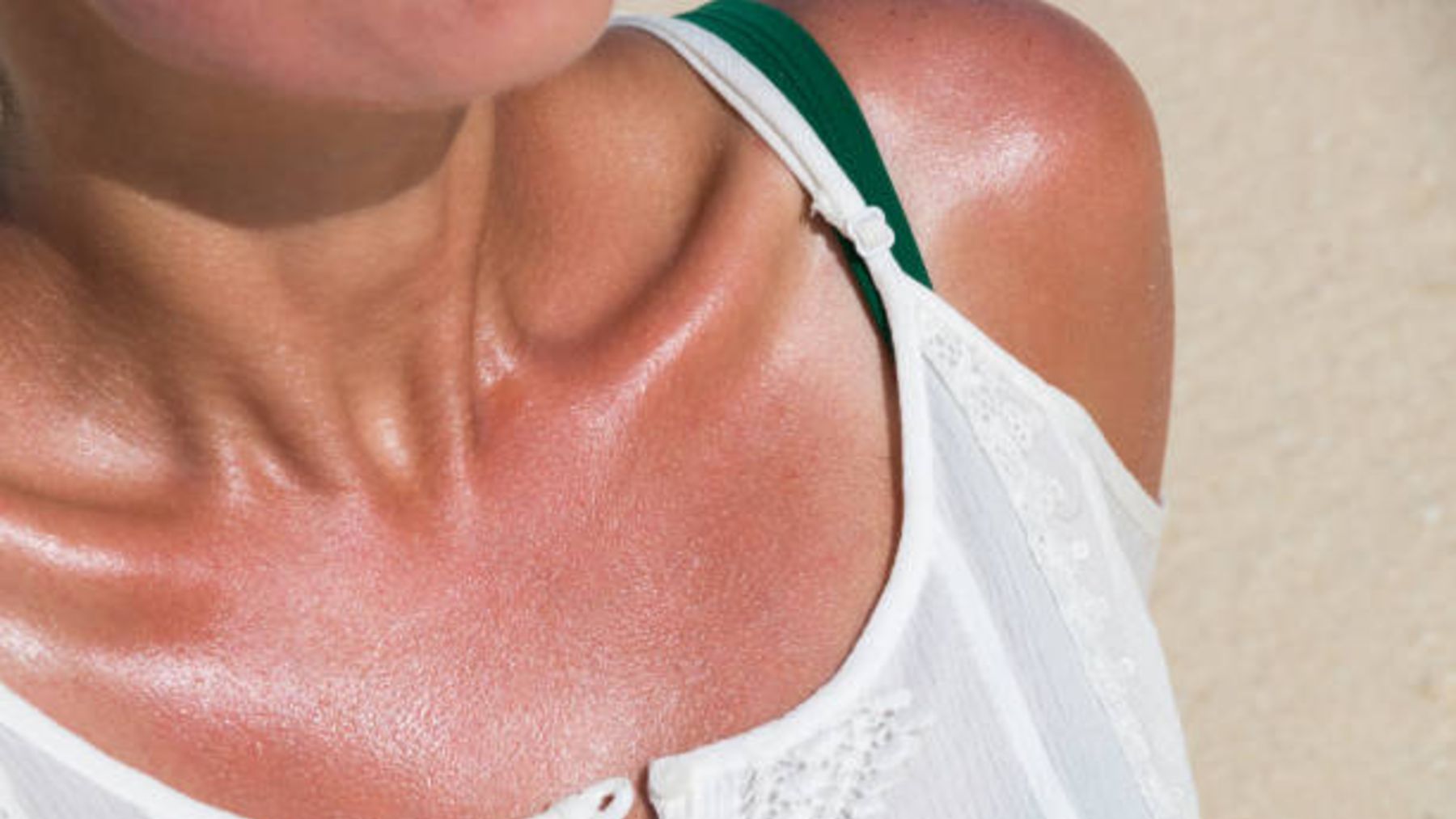 Cómo usar bicarbonato de sodio como remedio