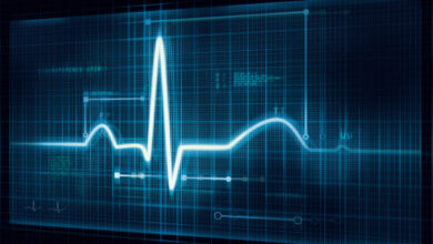 Cardiomatics gana $ 3.2 millones por su inteligencia artificial de lectura de ECG