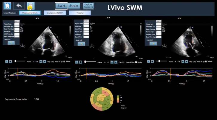 DiA de Israel obtiene $ 14 millones para expandir el análisis de ultrasonido impulsado por IA