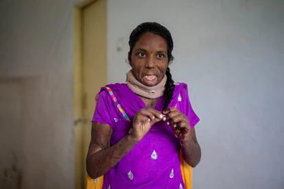 Jaya habla con las enfermeras del hospital Medicare de Pune mientras juega con su coleta.