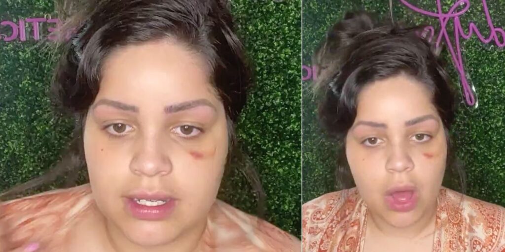 Novio de 90 días: Tiffany revela la razón de su ojo magullado