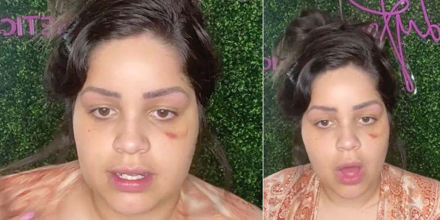 Novio de 90 días: Tiffany revela la razón de su ojo magullado