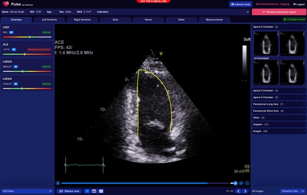 HeartLab, startup de Nueva Zelanda, recauda 2,45 millones de dólares para llevar software de escaneo cardíaco a EE. UU.