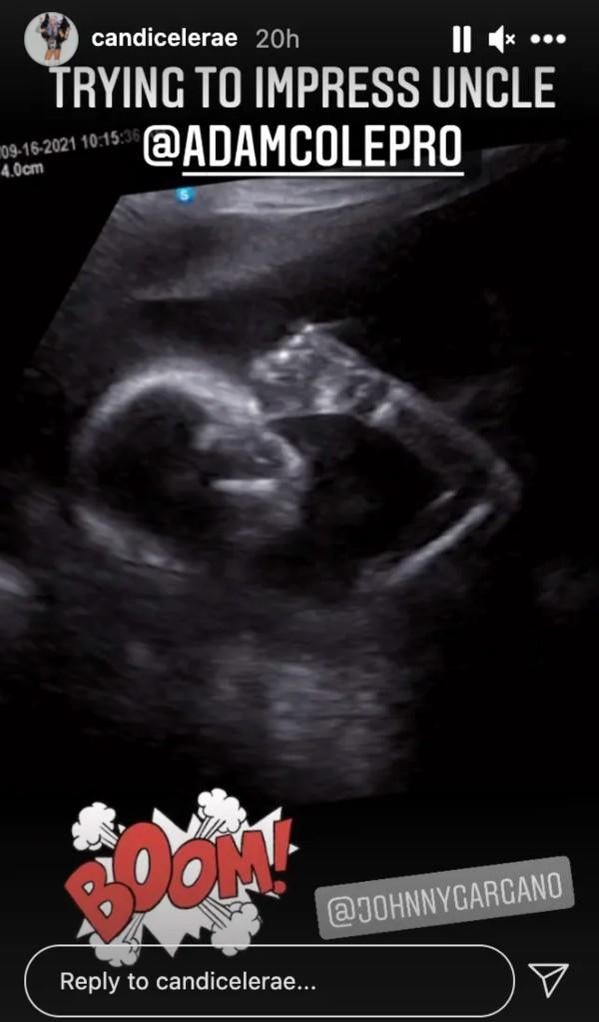 candice-lerae-baby-ultrasound.jpg candice-lerae-baby-ultrasound.jpg