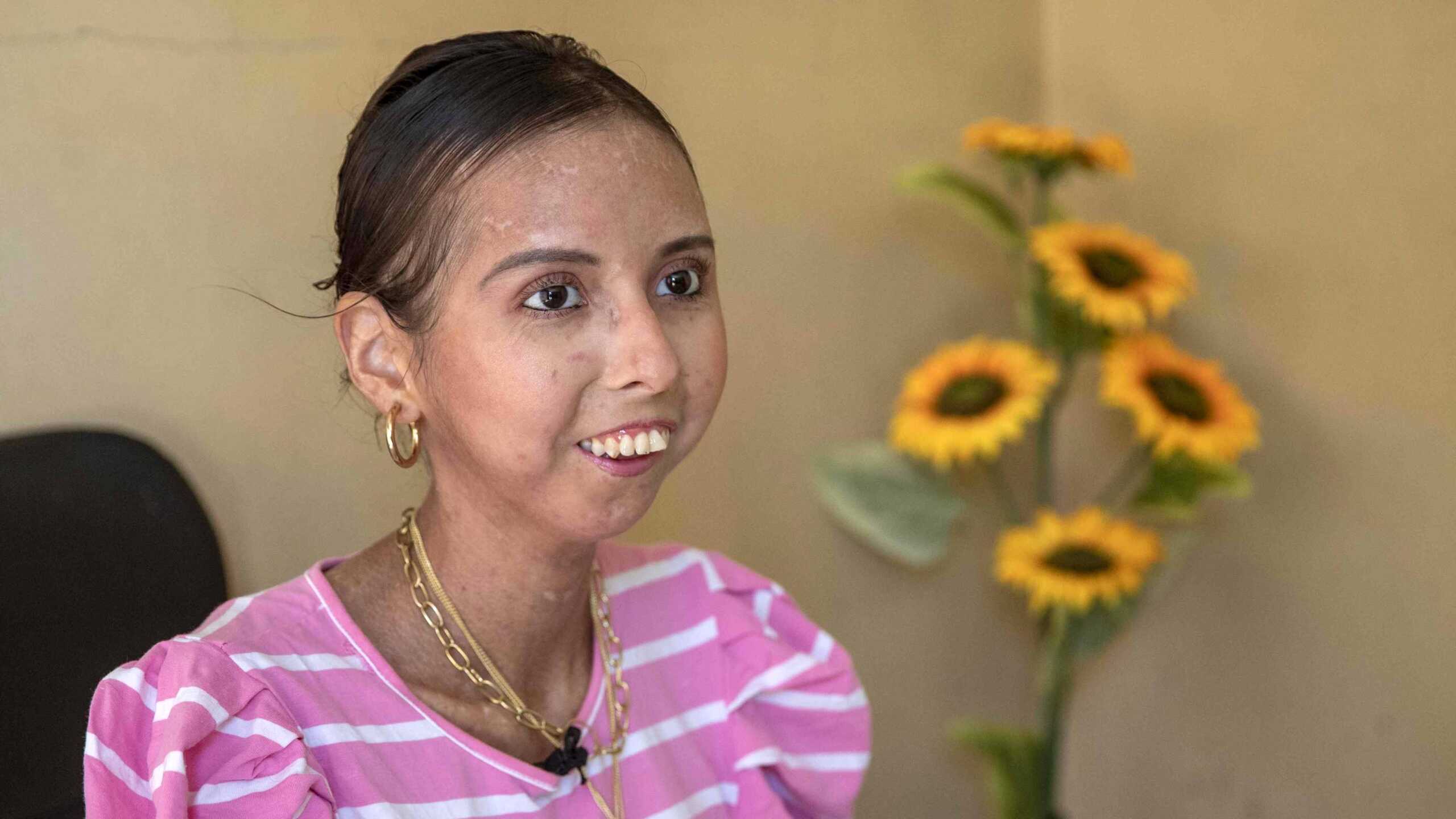 Joven a la que le dieron 2 años de vida cuenta cómo sobrevivió ese fatal pronóstico