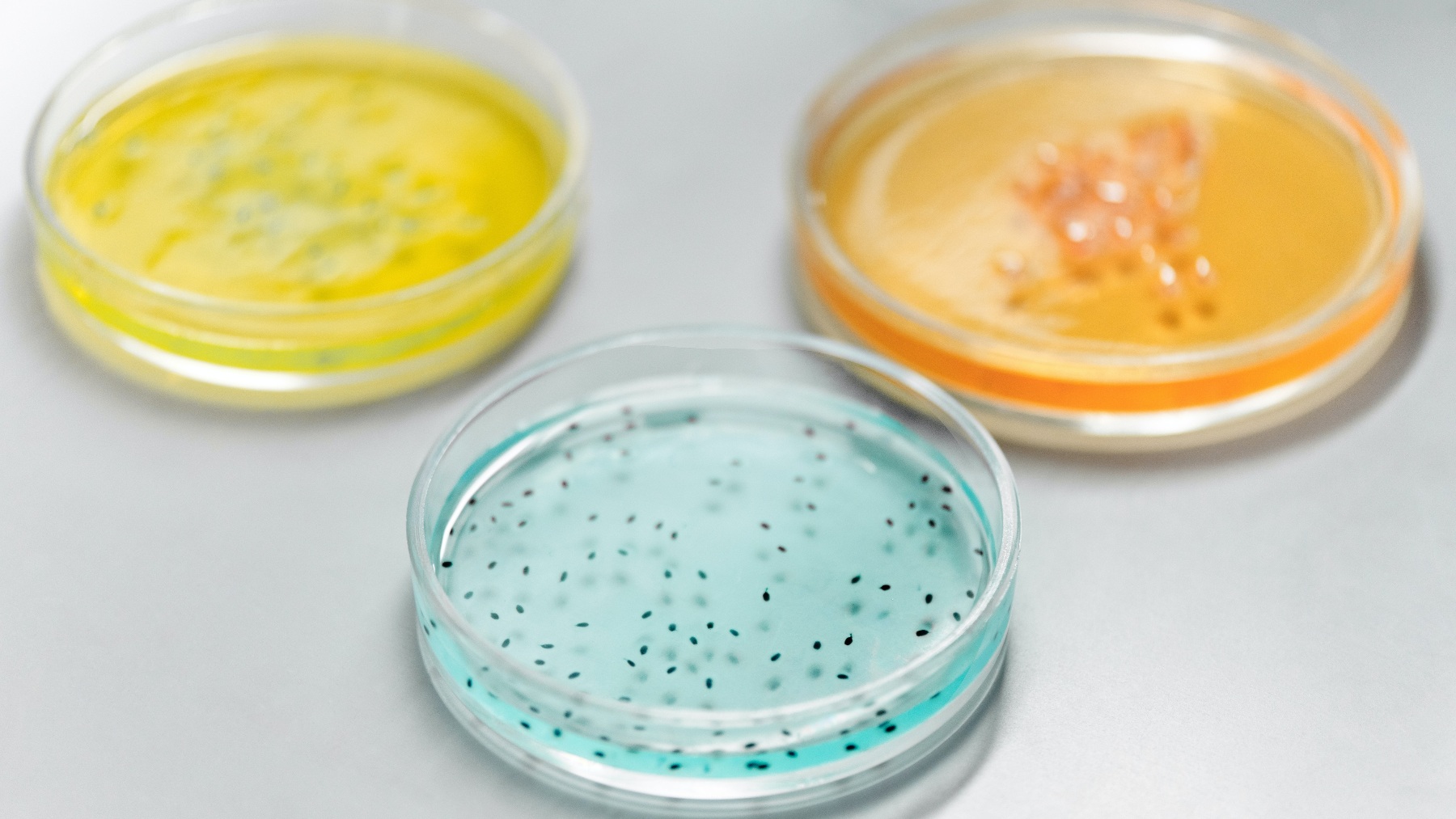 Virus y bacterias: Características y diferencias