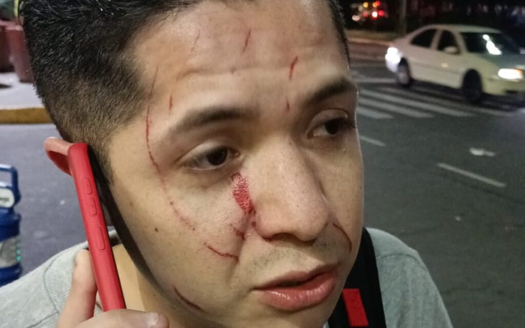 Condena Copred "agresiones homofóbicas" durante 'besotón' en Six Flags