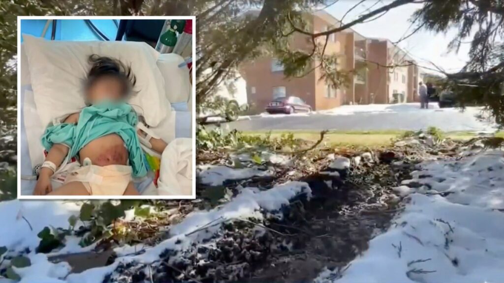 Niña hondureña necesitará meses de terapia para recuperarse de atropellamiento
