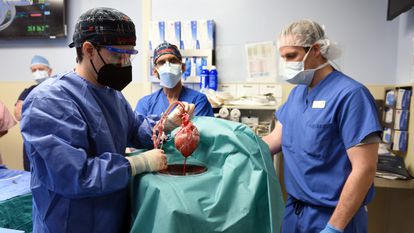 El equipo médico prepara el trasplante de un corazón porcino de Revivicor a David Bennett, en un quirófano de la Universidad de Maryland.