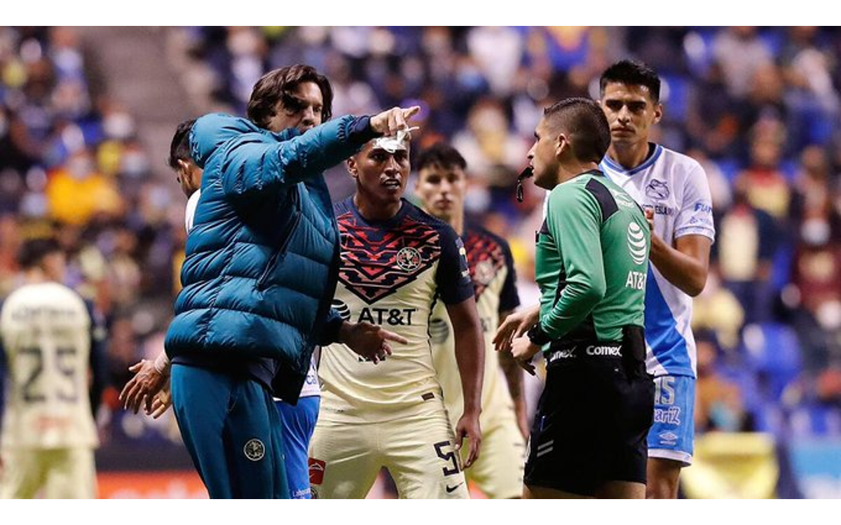 Cuesta a Santiago Solari su "ataque de locura" un partido de castigo | Video