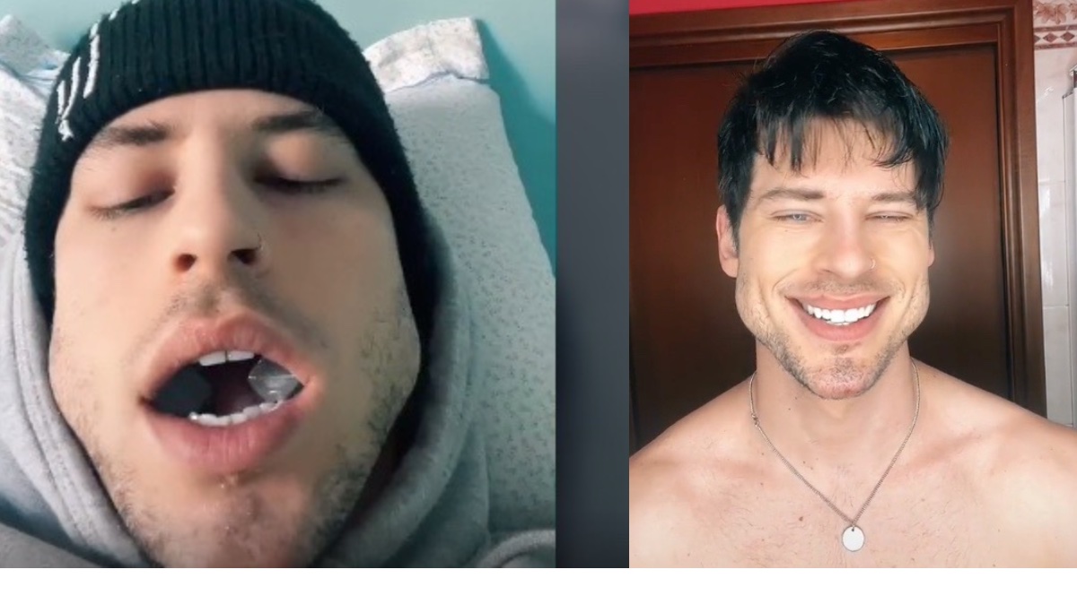 El modelo italiano que se ha hecho viral en TikTok por sus ejercicios para marcar la mandíbula