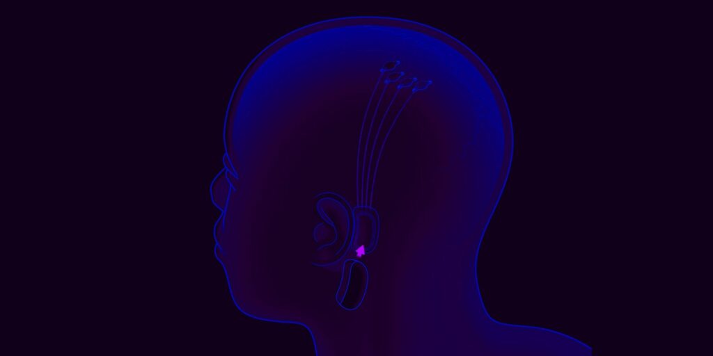 Neuralink de Elon Musk podría estar preparándose para las primeras pruebas en humanos