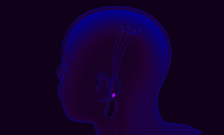 Neuralink de Elon Musk podría estar preparándose para las primeras pruebas en humanos