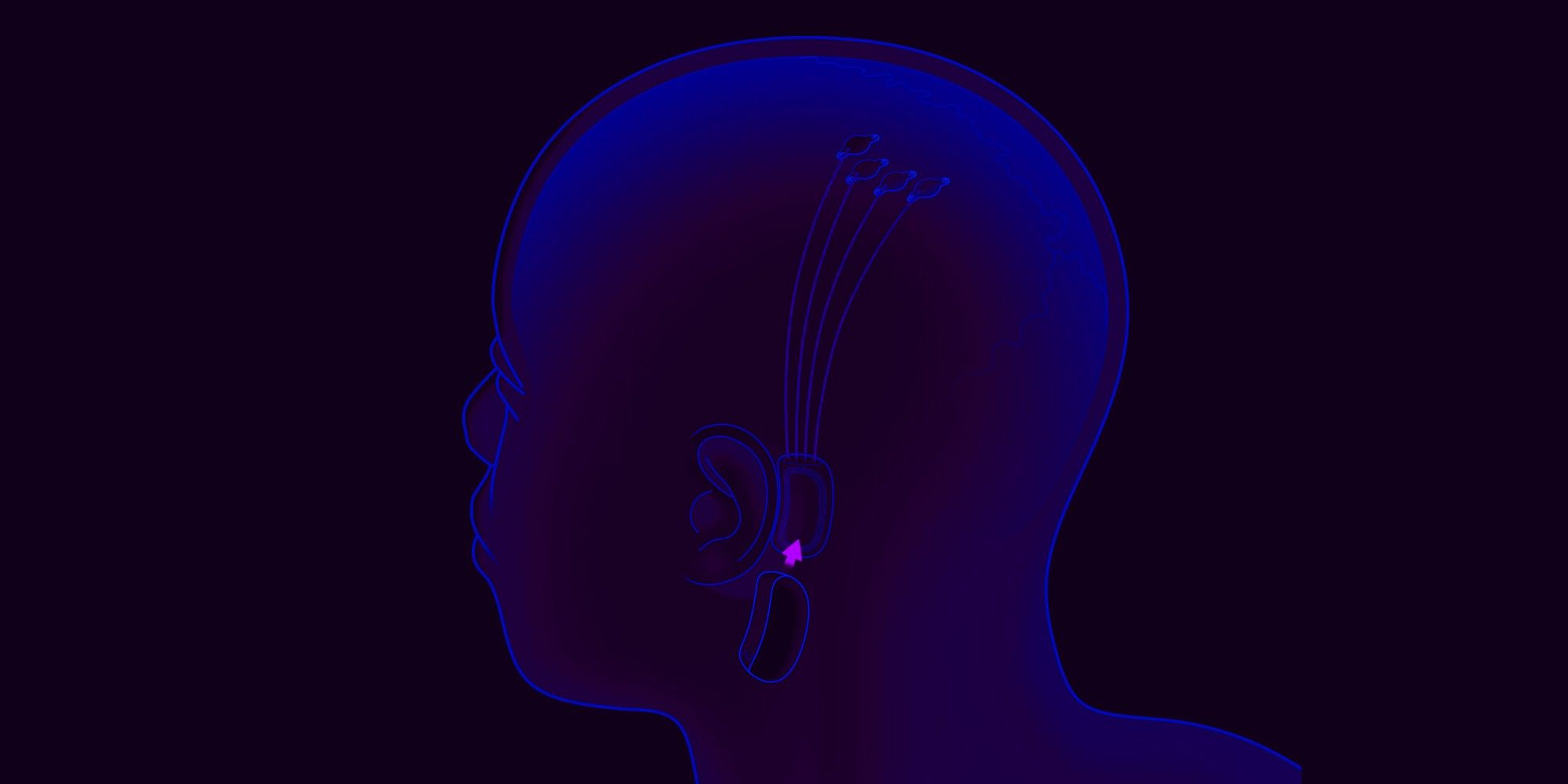 Neuralink de Elon Musk podría estar preparándose para las primeras pruebas en humanos