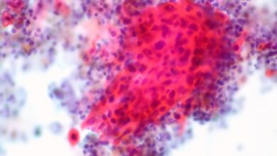 Paige, la startup de patología computacional que se enfoca en el cáncer, cierra una Serie B en $ 70M