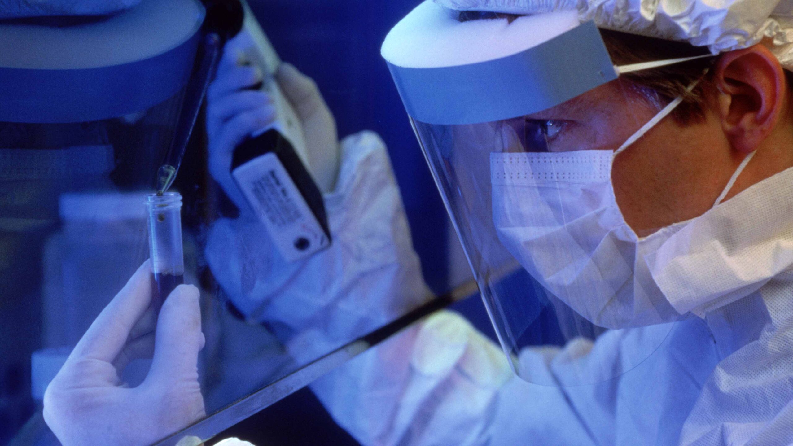 Identifican variante del VIH más agresiva; no representa un mayor riesgo