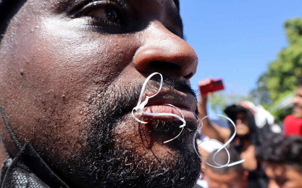 Migrantes se cosen la boca para exigir libre tránsito en México