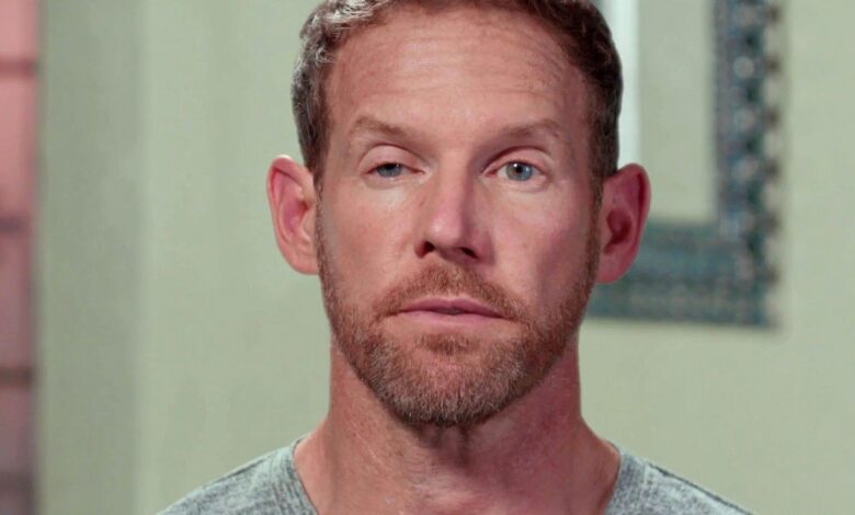 Todo en 90 Días: Ben Rathbun revela cómo realmente desarrolló un ojo 'torcido'