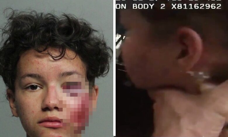 Revelan imagen de mujer golpeada tras arresto de policías de Miami