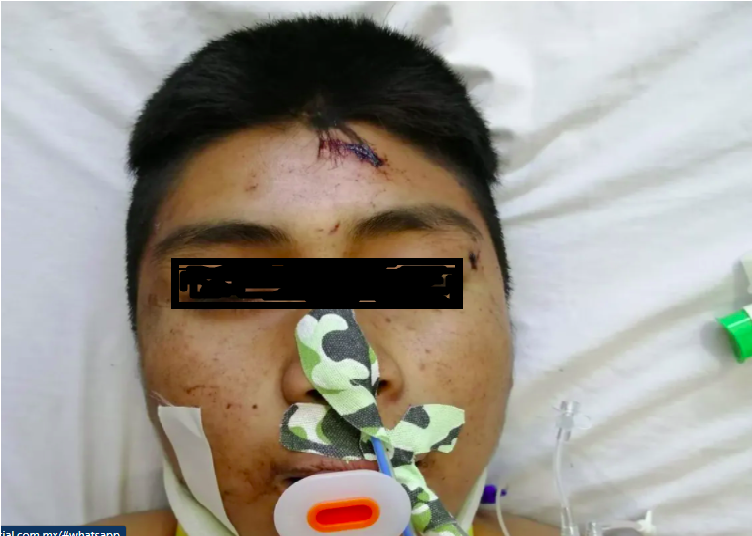 Abandonan a herido en Hospital de SJR, sobrevivió al accidente donde murieron 2 niños en Amealco