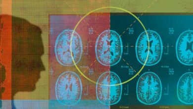 Combinación de herramientas de aprendizaje automático para imágenes médicas con redes de secuenciación genética Sophia Genetics $ 110M