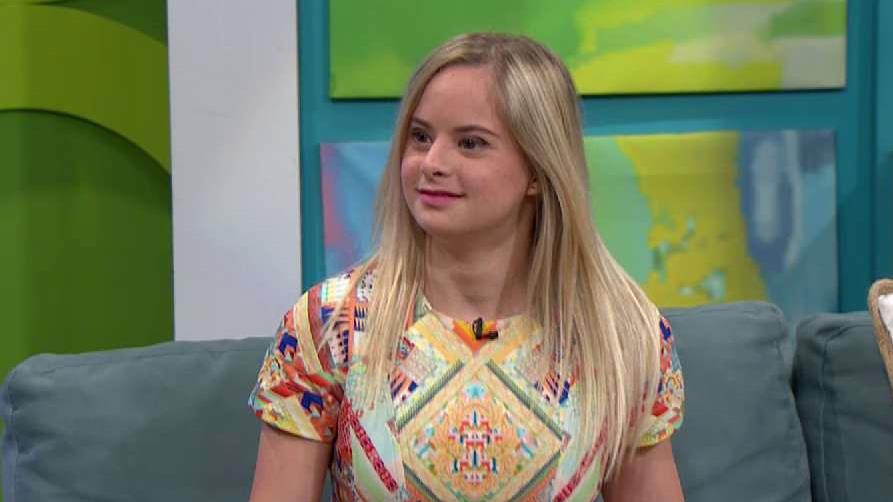 Ella es la primera persona con síndrome Down en modelar para Victoria’s Secret