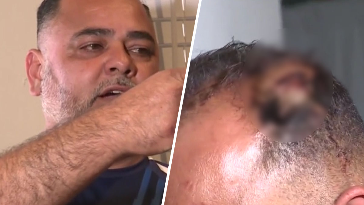 Habla camionero hispano de Houston que recibió balazo en la cabeza durante ataque en su casa