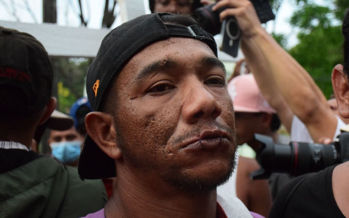 Migrantes se cosen los labios; piden a INM regularizar su estatus migratorio