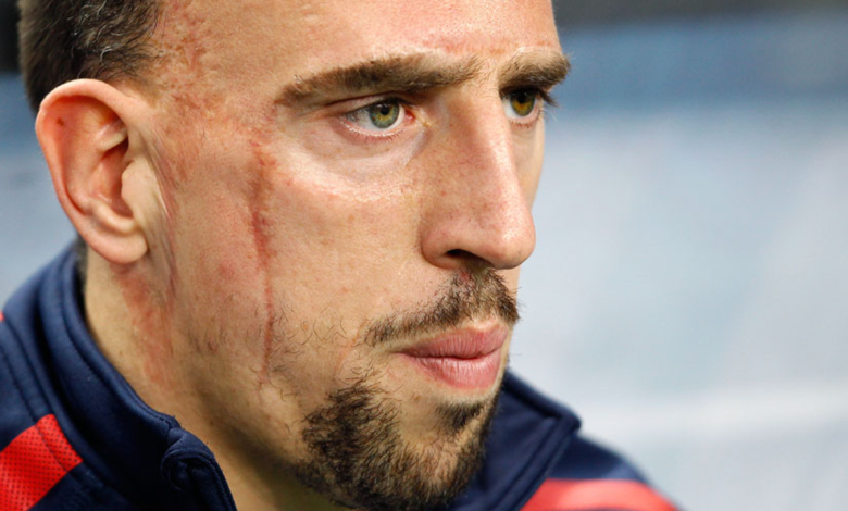 Salernitana multará a Ribéry tras su accidente de tránsito | Video