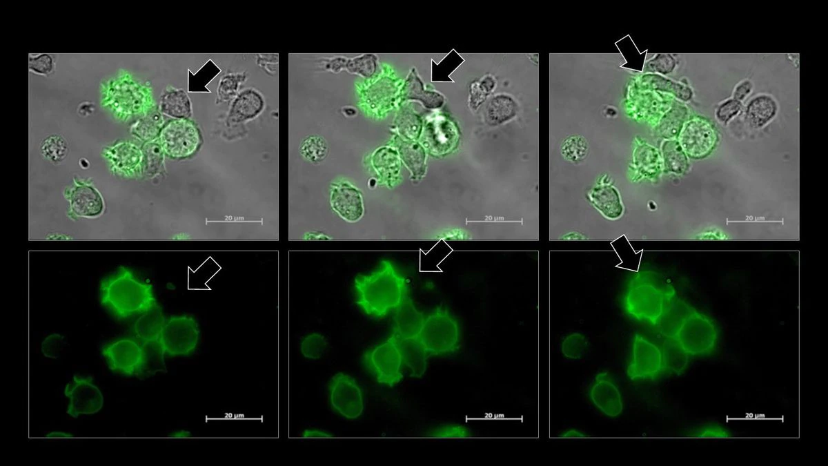 El beso letal entre las células del cáncer y las defensas del cuerpo humano