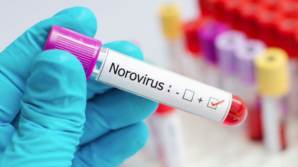 Norovirus: qué es, cuáles son sus síntomas y por qué los contagios están en aumento