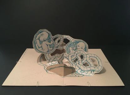 'Paralelismos superpuestos 